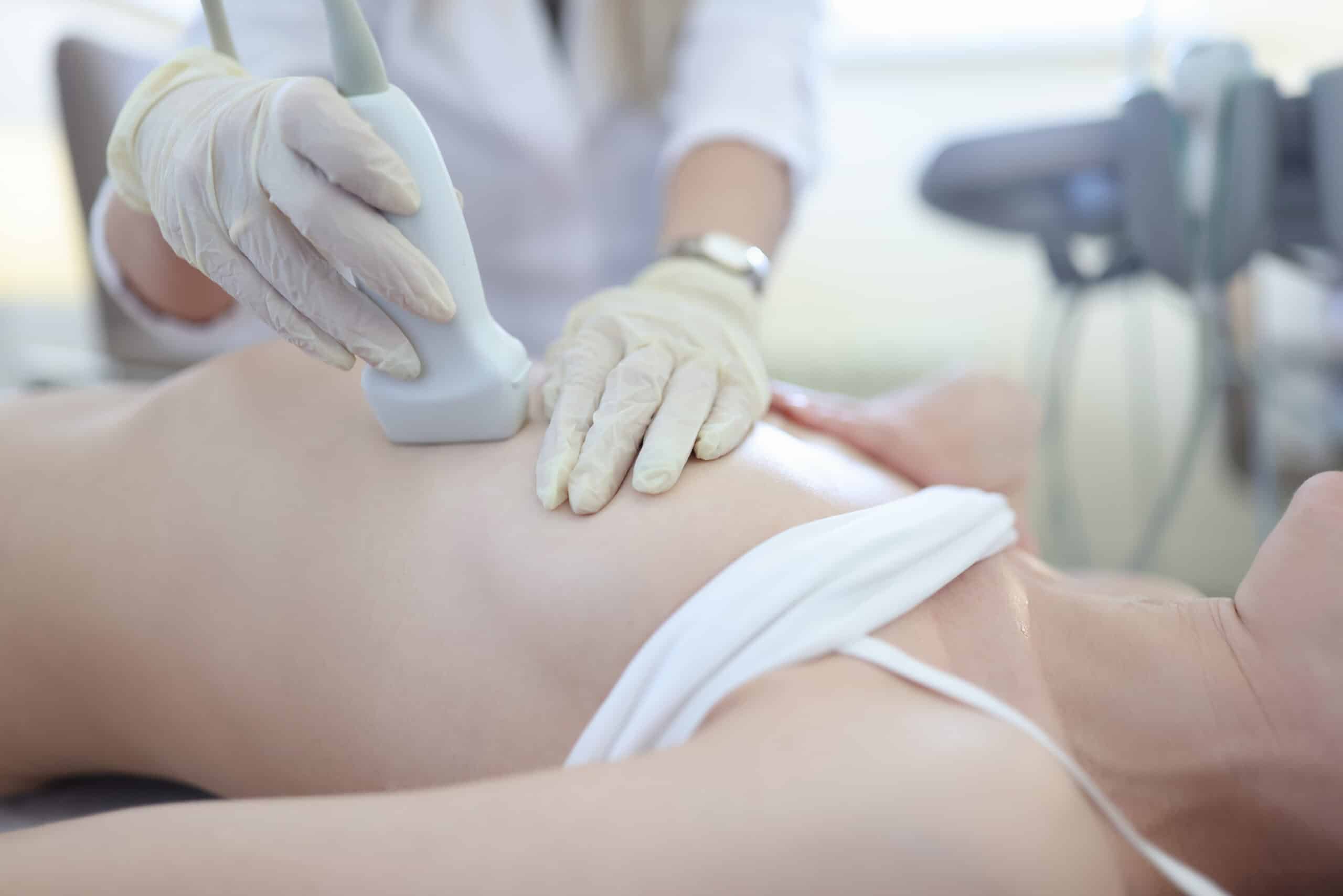 breast ultrasound